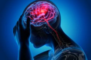 Langkah Pencegahan Hindari Stroke di Usia Muda