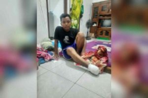 Warga Bantargebang Kesulitan Biaya Perawatan Sehari-hari setelah Kakinya Diamputasi