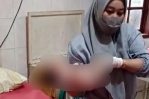 Bayi Dikerubuti Semut Ditemukan di Tarumajaya