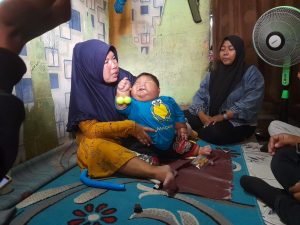 Ribuan Balita di Bekasi Obesitas