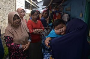 Kenzi Balita Obesitas  Dirujuk ke RSCM Jakarta
