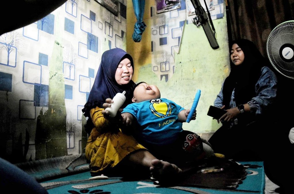Kenzi Balita Obesitas Jalani Rawat Jalan di RS Ananda