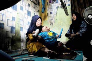 Kenzi Balita Obesitas Jalani Rawat Jalan di RS Ananda