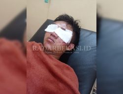 Korban Salah Tangkap Alami Gangguan Penglihatan