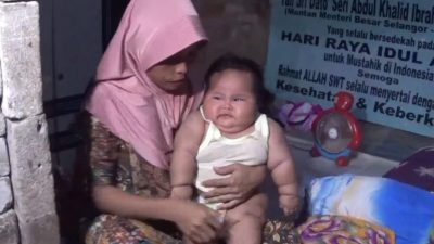 Raisya Bayi Obesitas 15 Kg Bakal Dirujuk ke RSCM