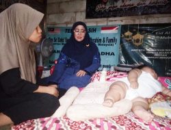 Siti Qomariyah Sambangi Balita Obesitas di Cabangbungin