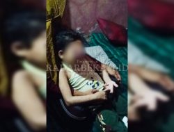Bocah Bekasi Derita Tumor Ganas, Keluarga Harapkan Penanganan Cepat Rumah Sakit