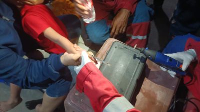 Anggota Disdamkarmat Butuh Satu Jam Lepaskan Ring Baut dari Jari Bocah di Mustikajaya   