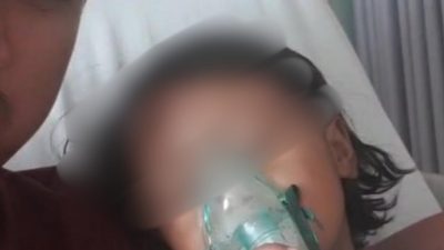 Puskesmas Tak Periksa Kondisi Korban Asap di Jatiluhur, Ini Alasannya