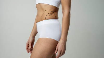 7 Cara Ampuh Mengatasi Stretch Mark pada Remaja, dari Bahan Alami hingga Perawatan Medis