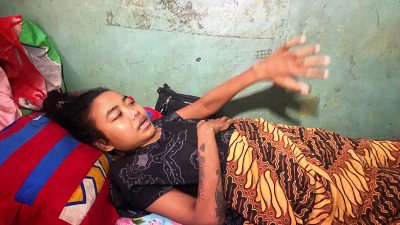 Nasib Ratih Warga Padurenan yang Mendadak Lumpuh Pasca Persalinan: Berhenti Bekerja, Anak Putus Sekolah