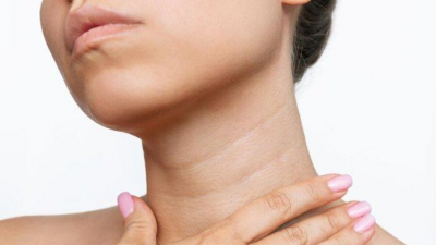 7 Cara Ampuh Memutihkan Kulit Leher, dari Bahan Alami hingga Terapi Medis
