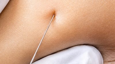 Diduga Salah Diberi Jenis Vaksin di Puskesmas Kota Bekasi, Bayi Sembilan Bulan Alami Radang Otak