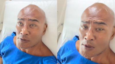 Deddy Corbuzier Mendadak Masuk Rumah Sakit dan Jalani Operasi, Alasan di Baliknya Bikin Tepok Jidat!