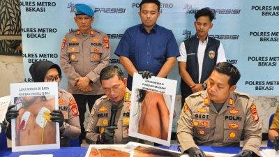 Balita di Tarumajaya Diduga Alami Kekerasan oleh Ibu Tiri, Polisi: Korban Masih Koma